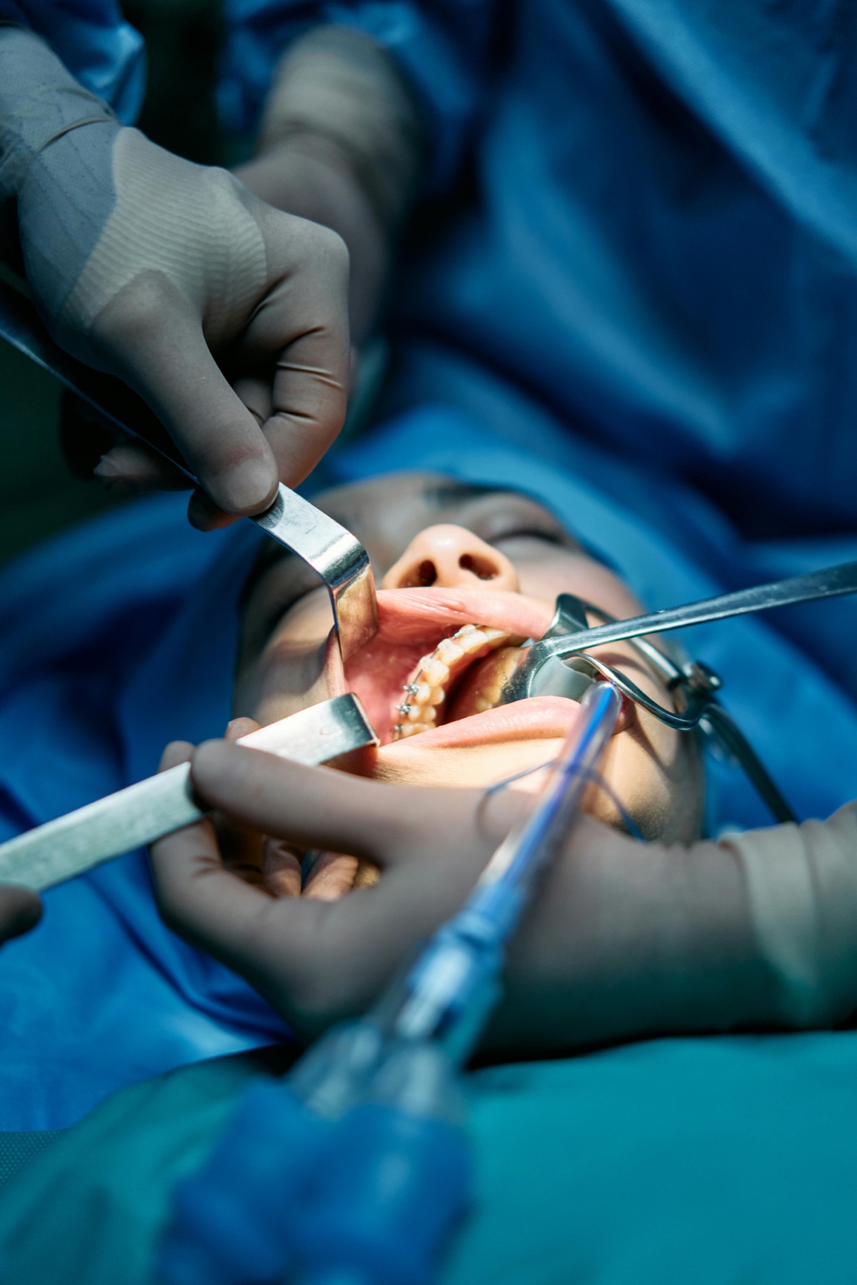 Cirurgias odontológicas